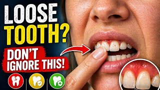 Why Is My Tooth Loose? 😳 Causes & What To Do