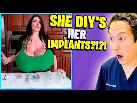 Plastic Surgeon Reacts to LARGEST Implants in US!...