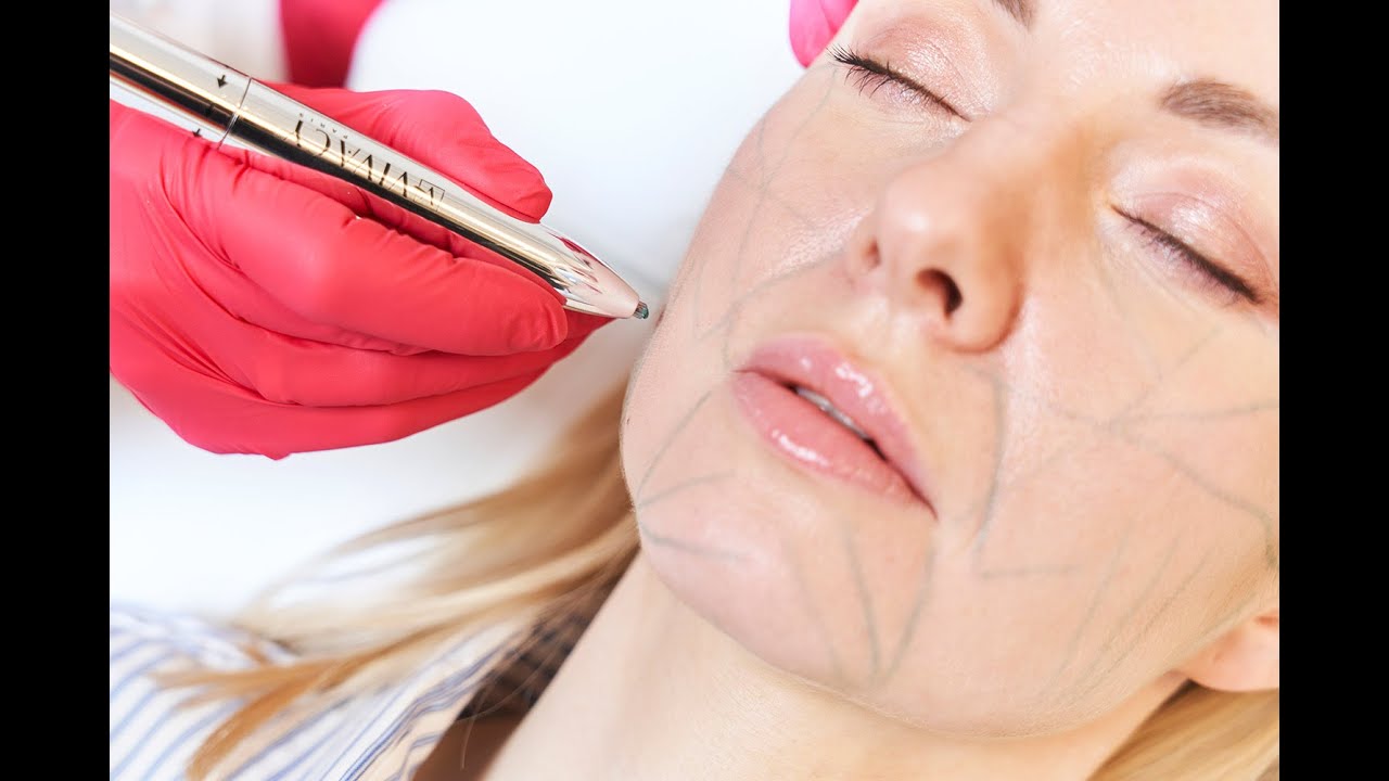 Ana Kucharski-Alekseenko-13