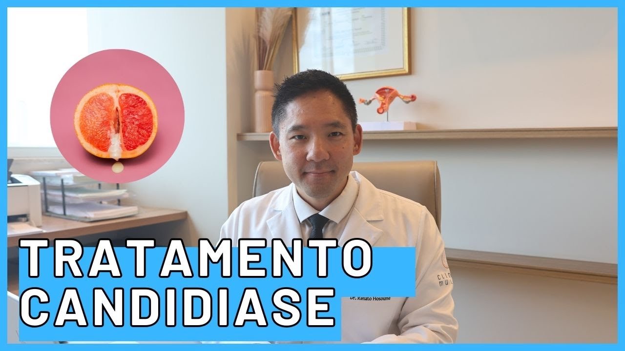 Nova Atualização no Tratamento da Candidíase: O Que Mudou e Como Se Tratar Corretamente