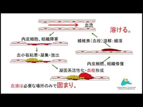 血栓症はなぜおこる？心筋梗塞、脳梗塞、エコノミークラス症候群にならないために