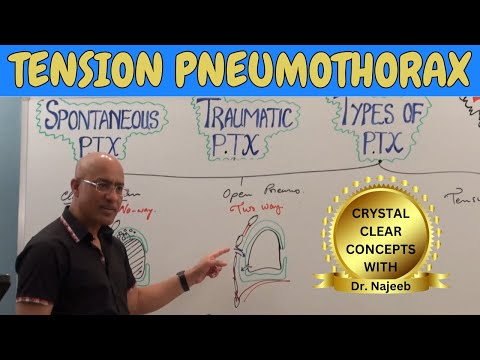 Tension pneumothorax | Causes, Clinical Correlations | Emergency Treatment🩺