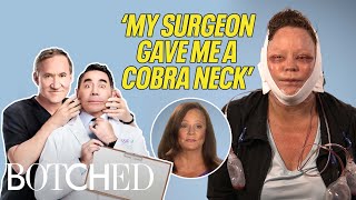 Download lagu Lisa Is a Cougar With A Cobra Neck?! (Before & After) | Botched | E! mp3