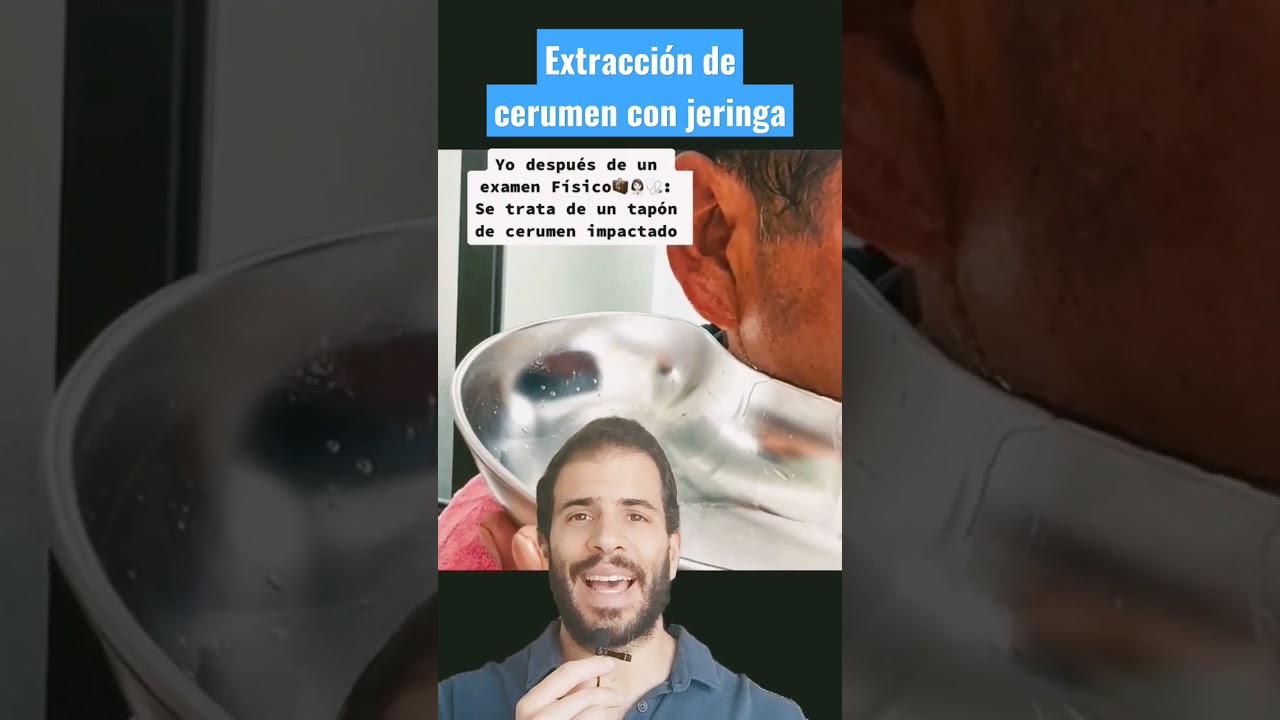 Earwax removal with a syringe and water