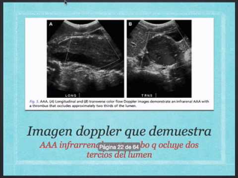 Fuga video