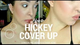 HOW TO: Concealing Hickeys & Chest Acne! | Mainly Drugstore