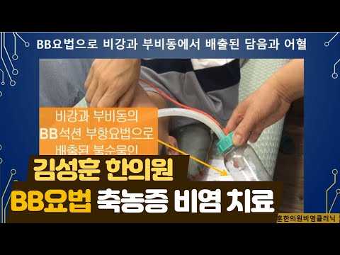 BB요법 직접 보기