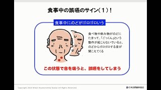 食事中の誤嚥のサイン