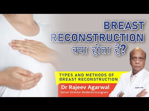 Types of breast reconstruction