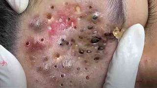 𝑺𝒐𝒐𝒕𝒉𝒊𝒏𝒈 𝑭𝒂𝒄𝒊𝒂𝒍 𝑻𝒓𝒆𝒂𝒕𝒎𝒆𝒏𝒕 𝑭𝒐𝒓 𝑺𝒕𝒓𝒆𝒔𝒔 𝑹𝒆𝒍𝒊𝒆𝒇 𝒂𝒕 𝑳𝒖𝒙𝒖𝒓𝒚 𝑺𝒑𝒂 𝑨𝒄𝒉𝒊𝒆𝒗𝒆 𝑰𝒏𝒏𝒆𝒓 𝑷𝒆𝒂𝒄𝒆 #500361