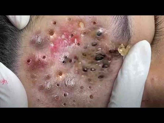 𝑺𝒐𝒐𝒕𝒉𝒊𝒏𝒈 𝑭𝒂𝒄𝒊𝒂𝒍 𝑻𝒓𝒆𝒂𝒕𝒎𝒆𝒏𝒕 𝑭𝒐𝒓 𝑺𝒕𝒓𝒆𝒔𝒔 𝑹𝒆𝒍𝒊𝒆𝒇 𝒂𝒕 𝑳𝒖𝒙𝒖𝒓𝒚 𝑺𝒑𝒂 𝑨𝒄𝒉𝒊𝒆𝒗𝒆 𝑰𝒏𝒏𝒆𝒓 𝑷𝒆𝒂𝒄𝒆 #500361