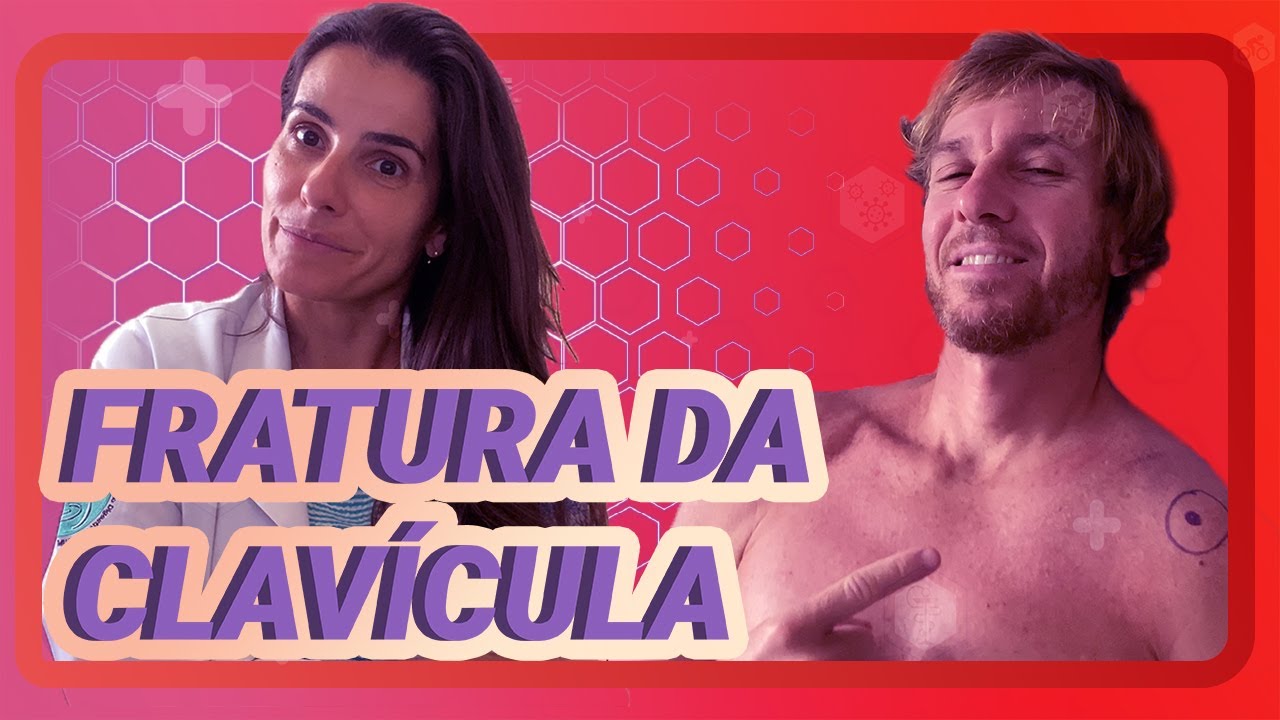FRATURA DE CLAVÍCULA EM ATLETAS | tudo sobre a fratura mais comum do ciclismo e outros esportes
