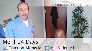 Hair Transplant 2 Week Followup | Traction Alopecia Hair Growth Products Don’t Compare (Mel)