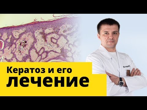 Боли в шее после кесарева что делать Спондилоартроз шейного отдела позвоночника лечится