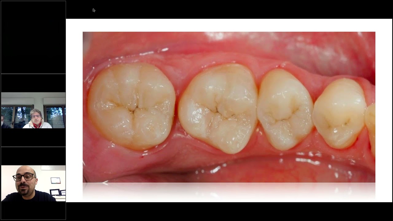 Riabilitazioni digitali