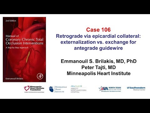 Case 106: Manual of CTO interventions: Retrograde via epicardial collateral