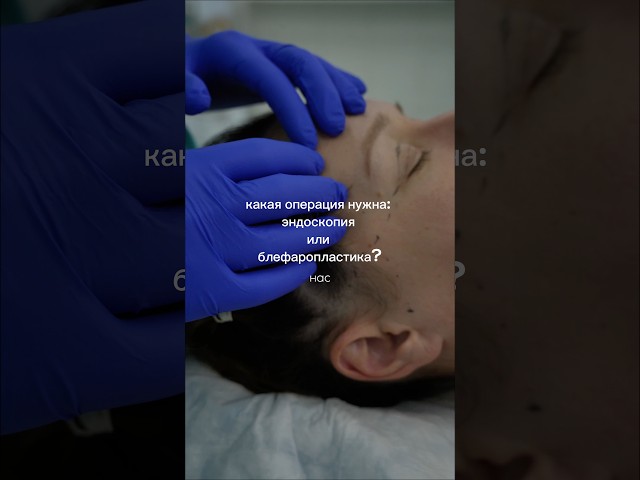ОЧЕНЬ ПОДВИЖНЫЕ ТКАНИ и нависшее веко