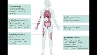 Toxic myopathies; muscle disorders caused by exposure to certain drugs, toxins, or chemicals