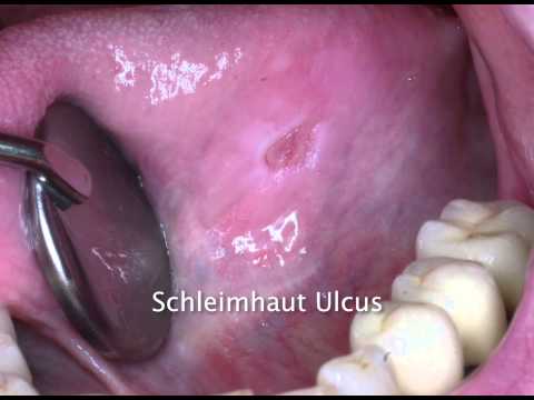Schmerzen im Steißbein und den unteren Rücken Schwindel und der Druck an der zervikalen Osteochondrose