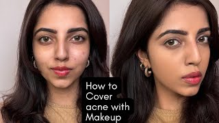 How To Cover ACNE With MAKEUP:Skincare + Color Correcting🫶🏻