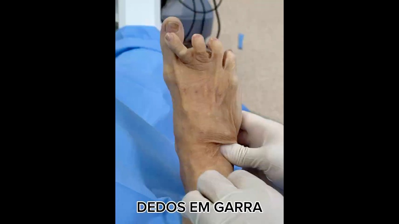 Pedro Felipe Araújo De Paula Santos-7