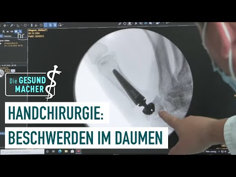 Joint prosthesis on the thumb | Experts for healthy hands | 3/5 | The Health Makers