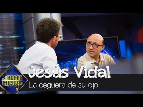 Jesús Vidal explica la enfermedad que le dejo ciego en uno de sus ojos - El Hormiguero 3.0