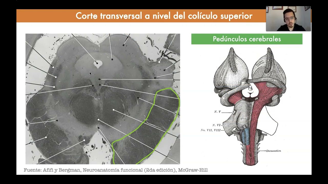 Tema 6. El mesencéfalo