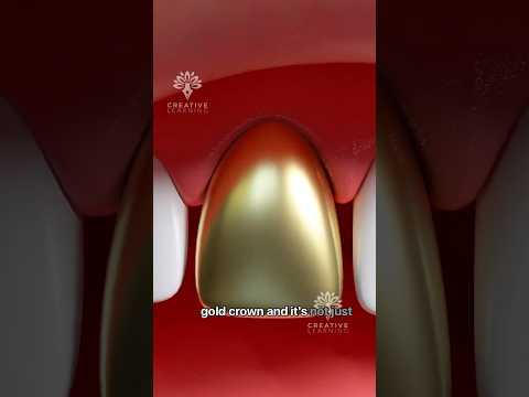 Why Do Some People Prefer Gold Tooth Over Porcelain? 🤔 #short #goldtooth- Creativelearning3d