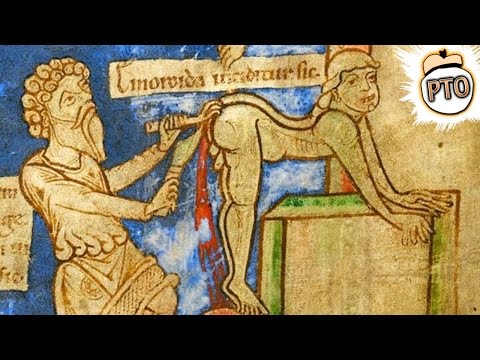 歴史に残る最悪の医者の治療法12選 (12 Worst Doctor Cures Throughout History)