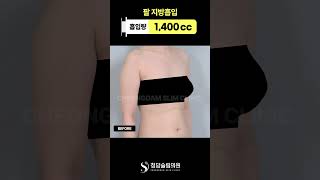 여름마다 가리고 다니던 곳, 이렇게 바뀜