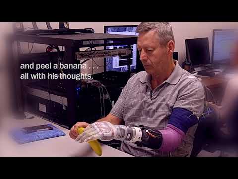 University of Utah researchers develop LUKE Arm Video