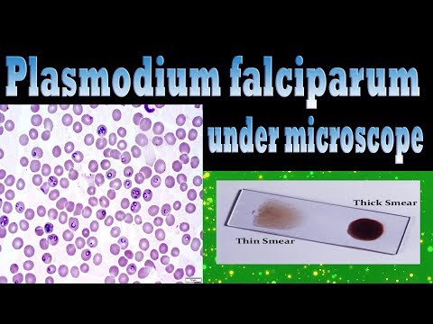 maláriás plazmodium schizonts
