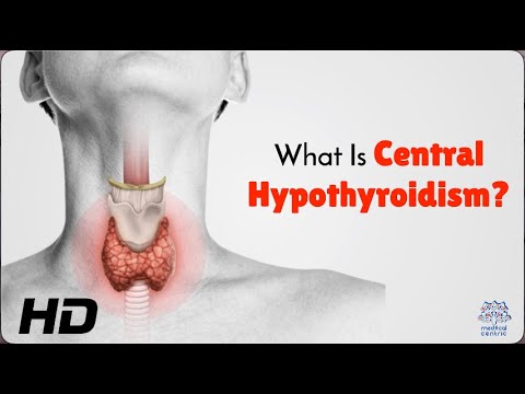 Diagnosing Central Hypothyroidism: What Makes It Different?