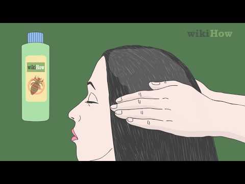 How to Get Rid of Lice