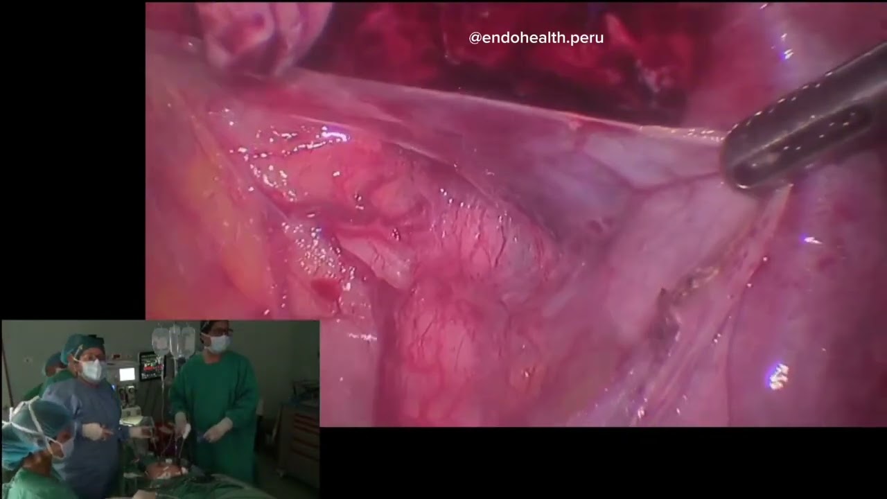 Gianmarco Ramirez Gonzales-3