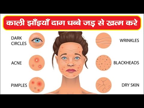 फेस स्किन इन्फेक्शन की समस्या | Face Skin Infection Problems | RM Ayurved | 📞 9411632933