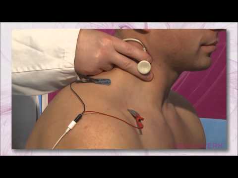 Motoric Neurography - Accessory Nerve