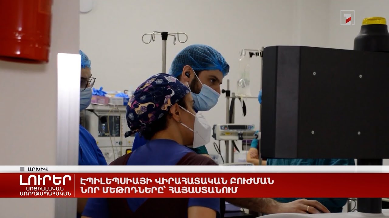Էպիլեպսիայի վիրահատական բուժման նոր մեթոդները՝ Հայաստանում