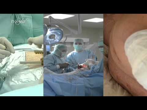 Kmenové buňky - Víkend TV NOVA