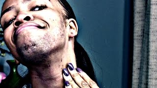 Why Am I Growing a Beard? | The Doctors