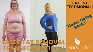 How ONE APPOINTMENT Changed Karen's Life Forever | Sono Bello