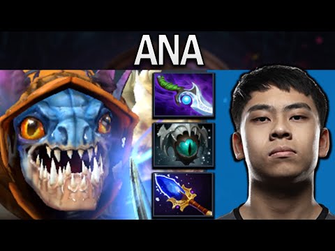 Slark Dota 2 Gameplay Ana with 22 Kills and Diffusal