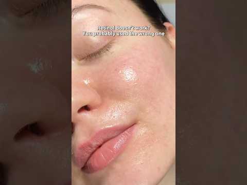 Retinol before and after | Real results, peeling, glow & how to use retinol for beginners