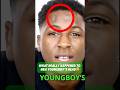 Why NBA Youngboy Has Holes In His Forehead Nbayoungboy Kingvon Lildurk