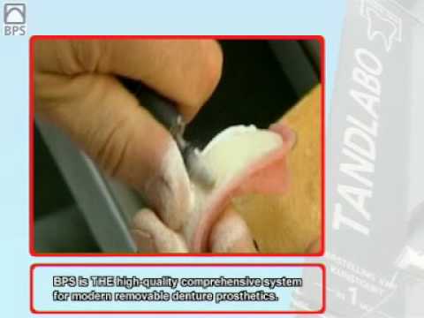 Informational Video about BPS Denture Prothetics