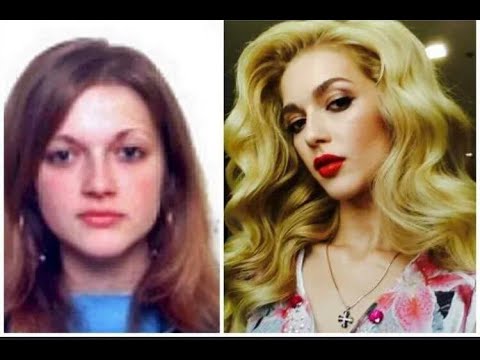 Herceg Erika reagált a plasztikáról szóló vádakra I Blikk