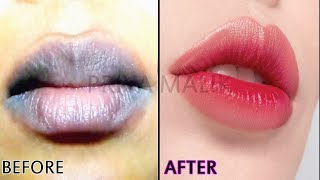 Get Soft Pink Lips Naturally at Home in 2 Easy Steps || How To Make Your Own Lip Balm