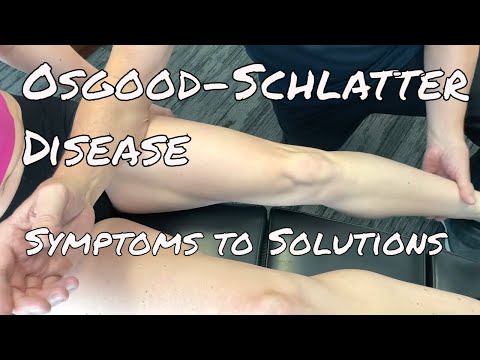 Osgood Schlatters Disease Uncovered: From Symptoms to Solutions