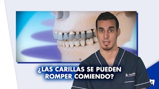 CONSERVACIÓN de las CARILLAS dentales - ¿Se pueden romper comiendo | #Shorts